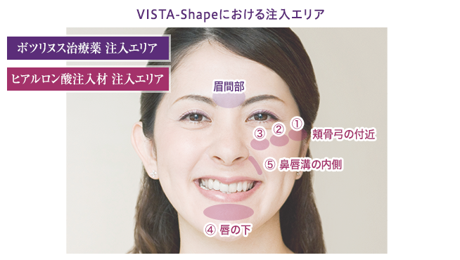 vista-shape_img_03.png